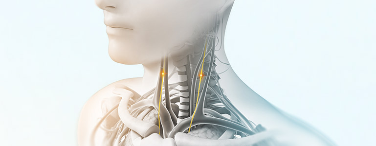 Vagus Nerve Stimulation Device